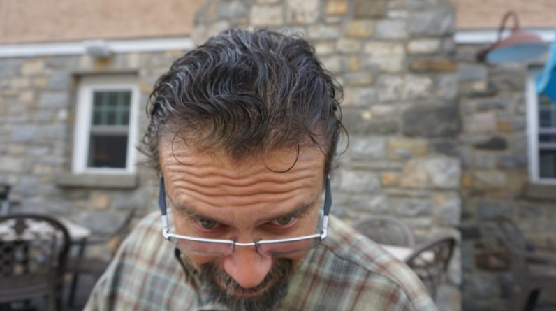 Haarausfall Produkte